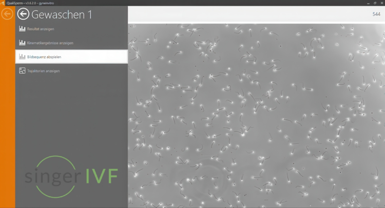 Spermiogram 2400