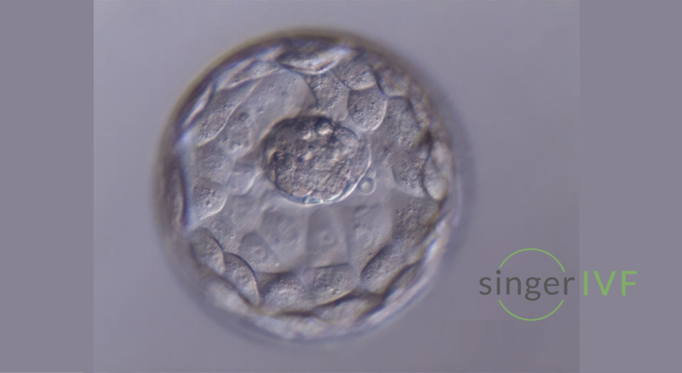 Wonderful blastocyst in Singer IVF lab