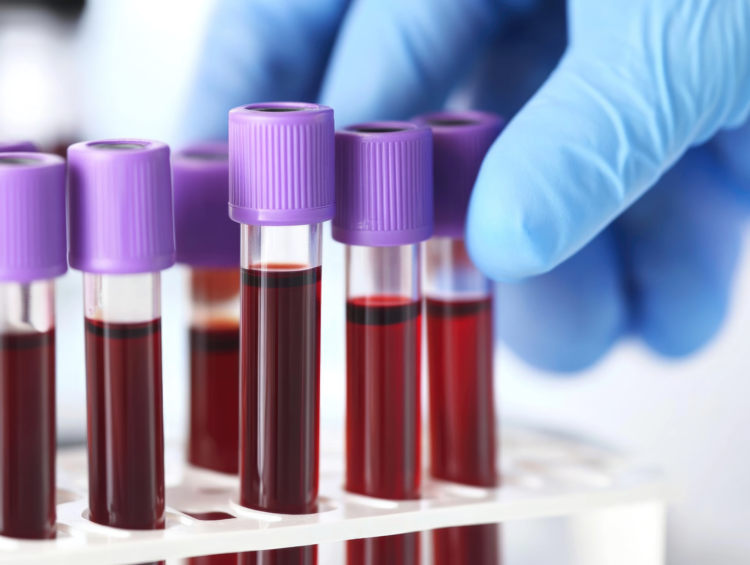 Close-Up of Gloved Hand Handling Blood Samples in Laboratory Vials with Purple Caps.