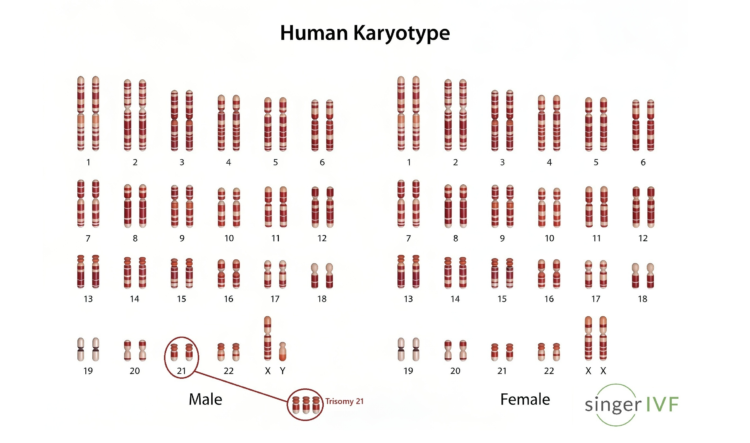 Karyotype singer ivf