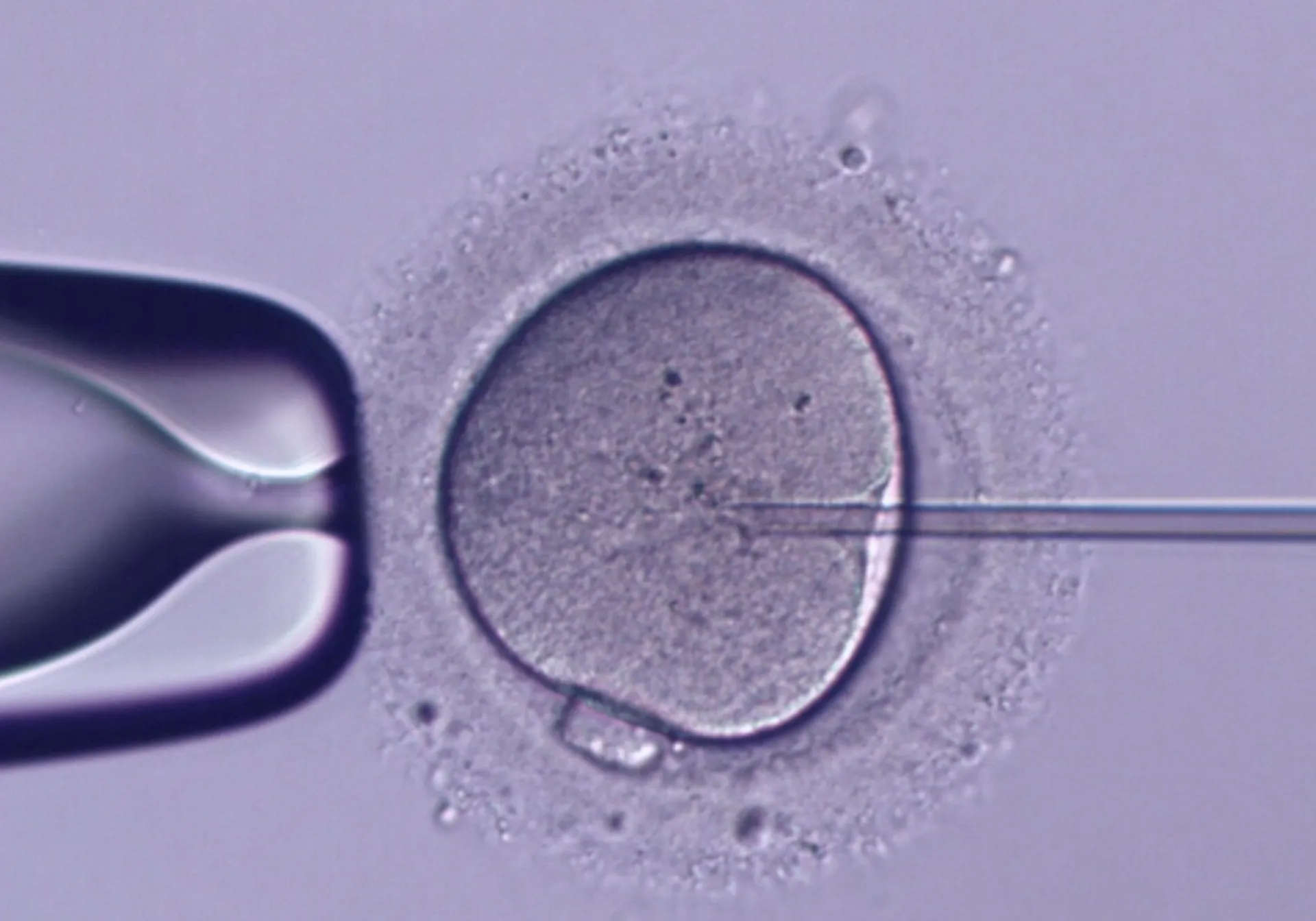 Singer IVF - ICSI procedure